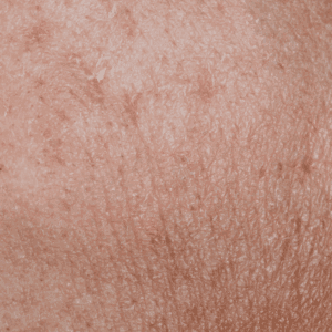 Soins Spécifiques Corps