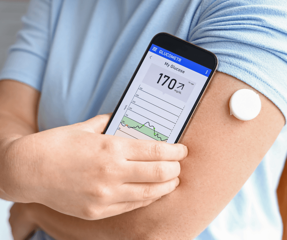 cgm