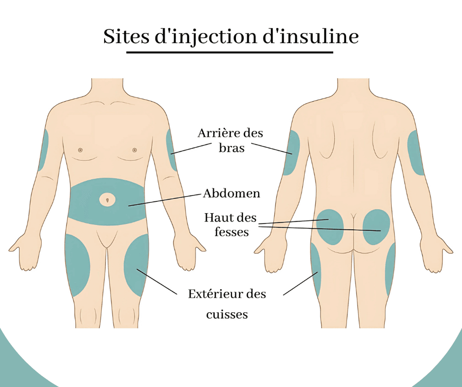 injection insuline