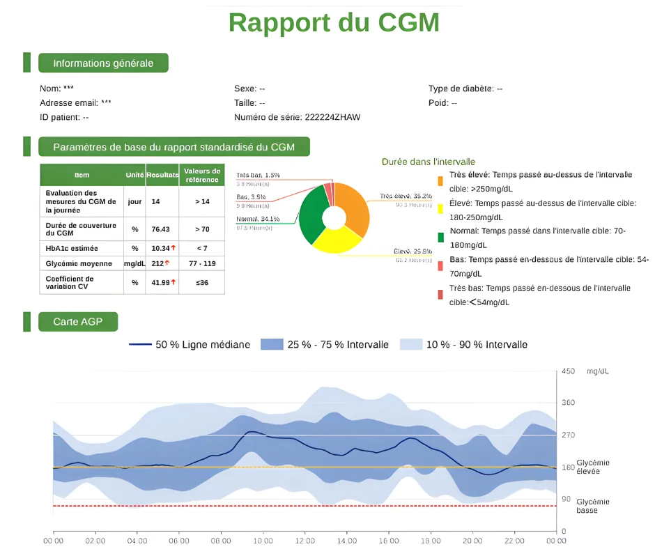 TIR TIME IN RANGE CGM
