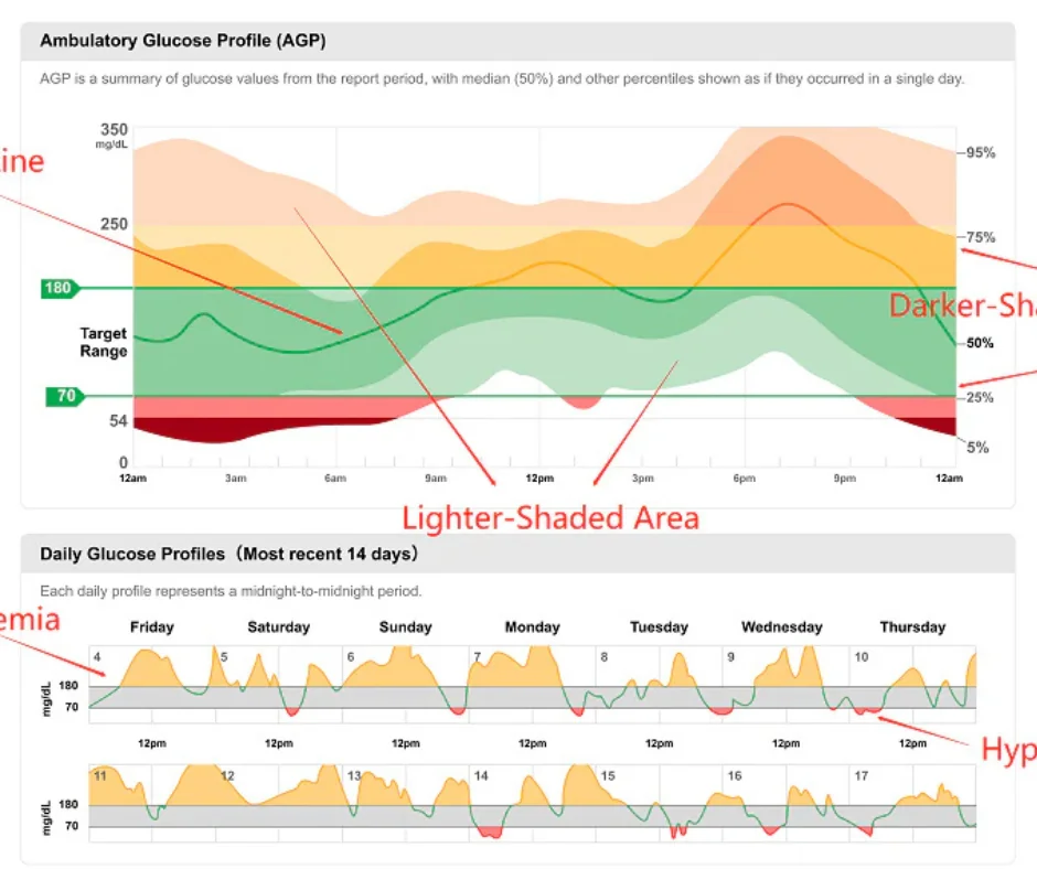 agp rapport cgm